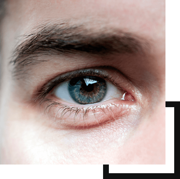 Picture of a single eye of a male model