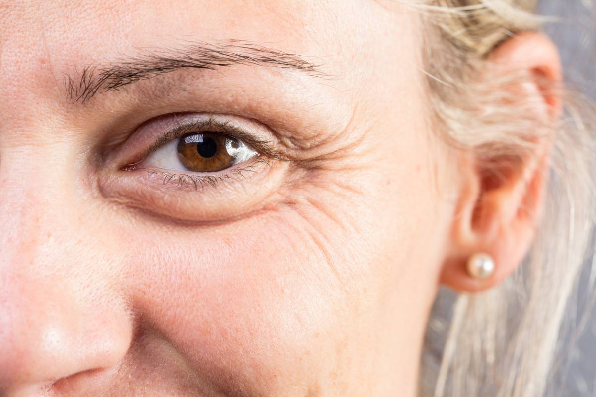 featured image for risk factors for eyelid skin cancer blog