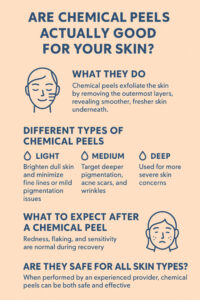 Infographic for Chemical Peels