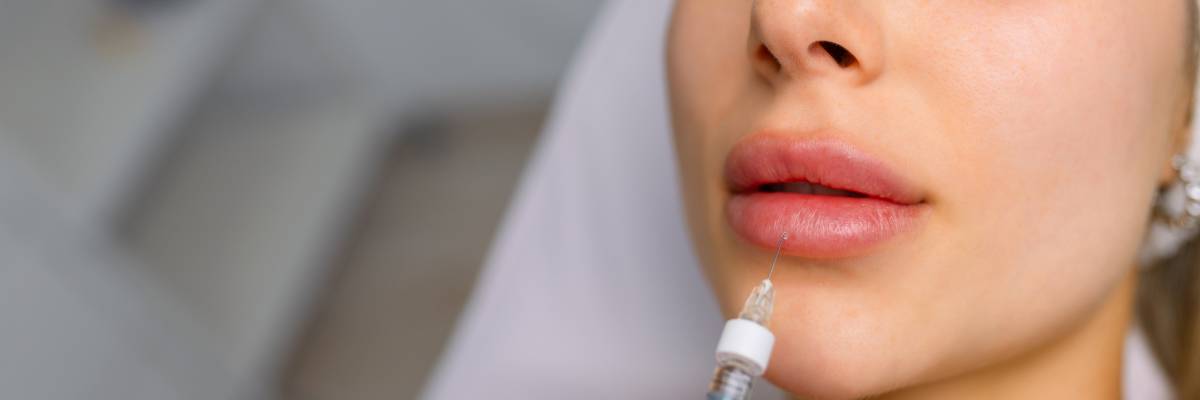 Injection procedure for lip augmentation, close